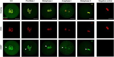 ASB7 Is a Novel Regulator of Cytoskeletal Organization During Oocyte Maturation
